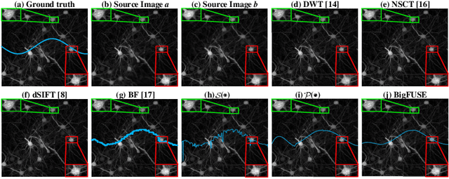 Figure 3 for BigFUSE: Global Context-Aware Image Fusion in Dual-View Light-Sheet Fluorescence Microscopy with Image Formation Prior