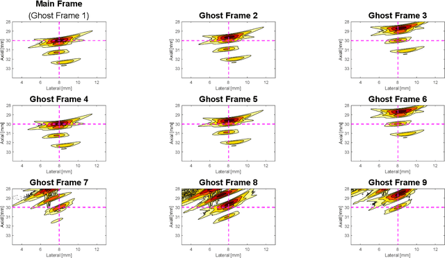 Figure 3 for Improved Row-Column-Addressed Array Imaging by Leveraging Ghost Echoes