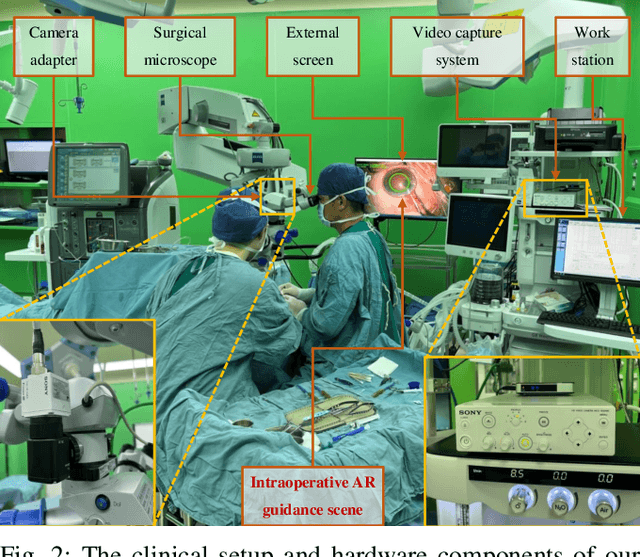 Figure 2 for Phase-Specific Augmented Reality Guidance for Microscopic Cataract Surgery Using Long-Short Spatiotemporal Aggregation Transformer