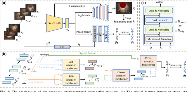 Figure 3 for Phase-Specific Augmented Reality Guidance for Microscopic Cataract Surgery Using Long-Short Spatiotemporal Aggregation Transformer