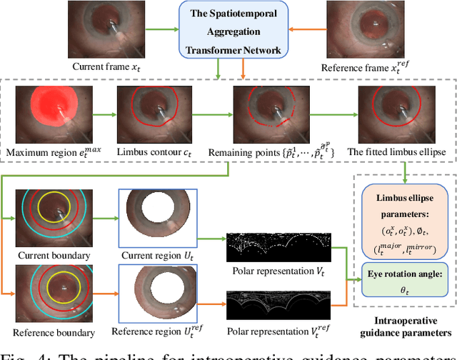 Figure 4 for Phase-Specific Augmented Reality Guidance for Microscopic Cataract Surgery Using Long-Short Spatiotemporal Aggregation Transformer