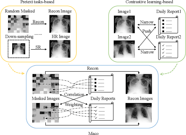Figure 1 for Enhancing Representation in Radiography-Reports Foundation Model: A Granular Alignment Algorithm Using Masked Contrastive Learning