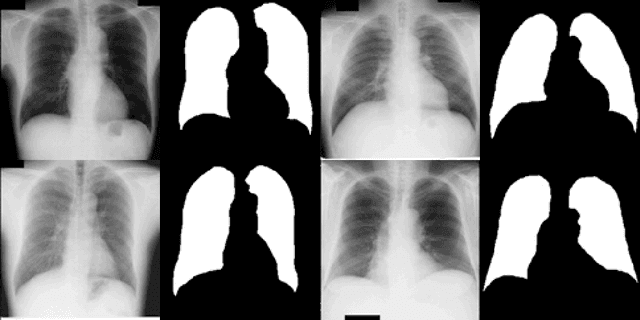 Figure 1 for UNet Based Pipeline for Lung Segmentation from Chest X-Ray Images