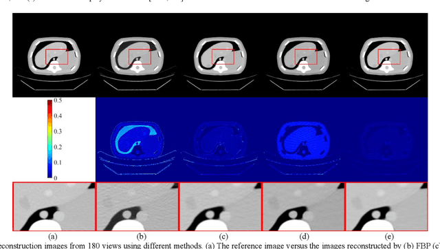 Figure 3 for Generative Modeling in Sinogram Domain for Sparse-view CT Reconstruction