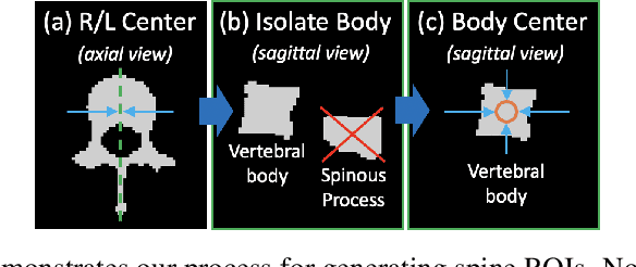 Figure 3 for Comp2Comp: Open-Source Body Composition Assessment on Computed Tomography