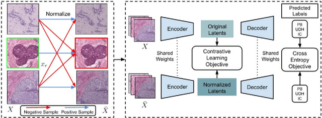 Figure 1 for Stain-invariant self supervised learning for histopathology image analysis