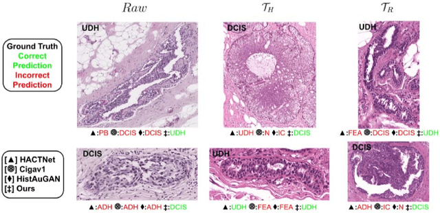 Figure 3 for Stain-invariant self supervised learning for histopathology image analysis