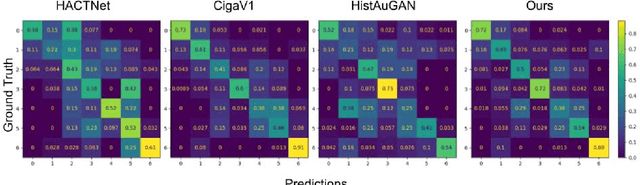 Figure 4 for Stain-invariant self supervised learning for histopathology image analysis