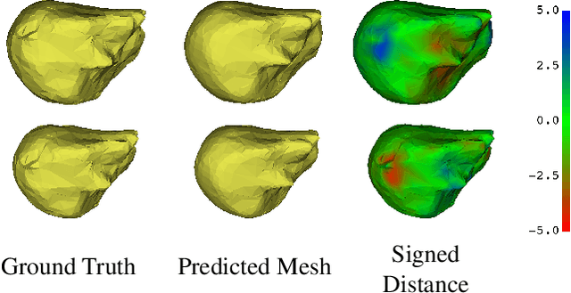Figure 3 for End-to-end Deformable Attention Graph Neural Network for Single-view Liver Mesh Reconstruction
