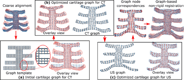 Figure 3 for Thoracic Cartilage Ultrasound-CT Registration using Dense Skeleton Graph