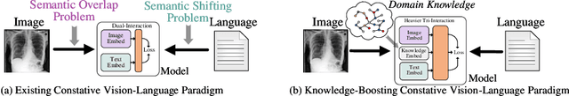 Figure 1 for Knowledge Boosting: Rethinking Medical Contrastive Vision-Language Pre-Training