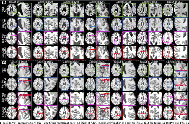 Figure 4 for Brain Anatomy Prior Modeling to Forecast Clinical Progression of Cognitive Impairment with Structural MRI