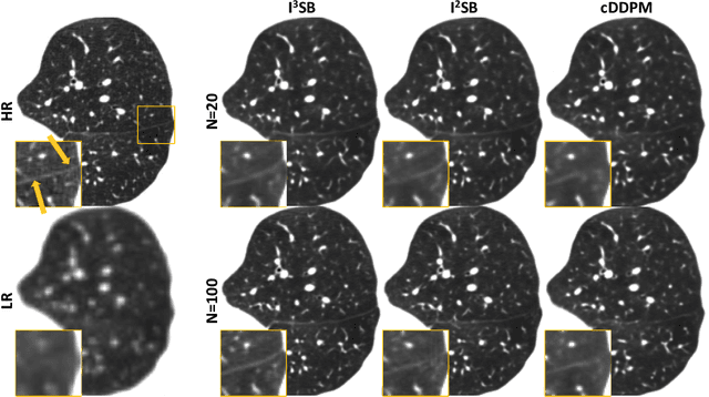 Figure 3 for Implicit Image-to-Image Schrodinger Bridge for CT Super-Resolution and Denoising