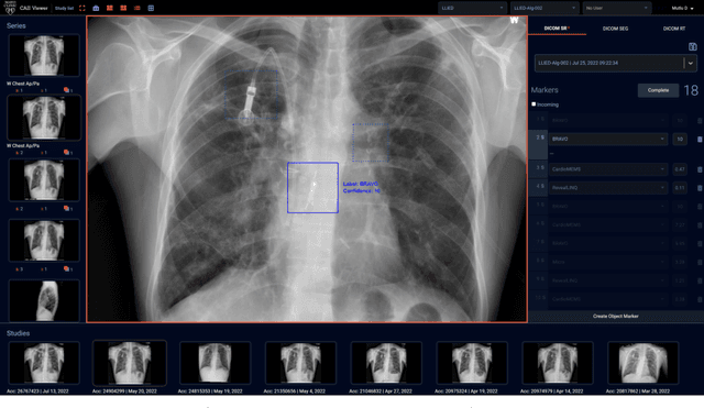 Figure 4 for Current State of Community-Driven Radiological AI Deployment in Medical Imaging