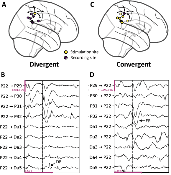 Figure 1 for Localising the Seizure Onset Zone from Single-Pulse Electrical Stimulation Responses with a Transformer