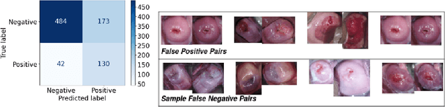 Figure 3 for AI-Assisted Cervical Cancer Screening