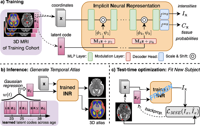 Figure 1 for CINA: Conditional Implicit Neural Atlas for Spatio-Temporal Representation of Fetal Brains