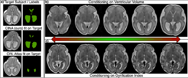 Figure 3 for CINA: Conditional Implicit Neural Atlas for Spatio-Temporal Representation of Fetal Brains