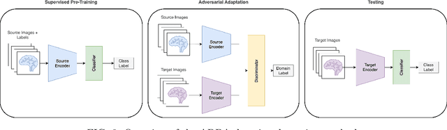 Figure 3 for Application of Unsupervised Domain Adaptation for Structural MRI Analysis