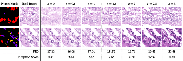 Figure 3 for NASDM: Nuclei-Aware Semantic Histopathology Image Generation Using Diffusion Models