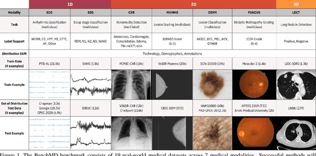 Figure 1 for BenchMD: A Benchmark for Modality-Agnostic Learning on Medical Images and Sensors