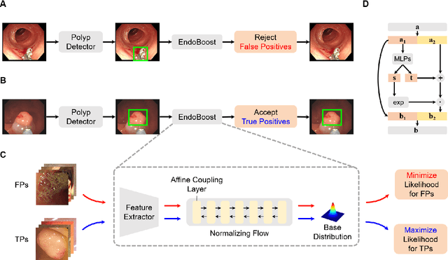 Figure 3 for EndoBoost: a plug-and-play module for false positive suppression during computer-aided polyp detection in real-world colonoscopy (with dataset)