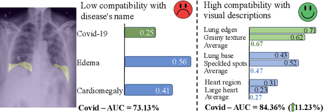 Figure 1 for Decomposing Disease Descriptions for Enhanced Pathology Detection: A Multi-Aspect Vision-Language Matching Framework