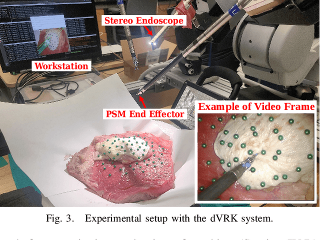 Figure 3 for Semantic-SuPer: A Semantic-aware Surgical Perception Framework for Endoscopic Tissue Classification, Reconstruction, and Tracking