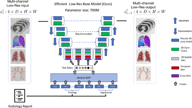 Figure 3 for MedSyn: Text-guided Anatomy-aware Synthesis of High-Fidelity 3D CT Images