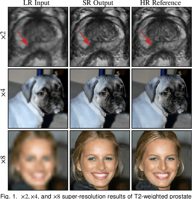 Figure 1 for PartDiff: Image Super-resolution with Partial Diffusion Models