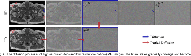 Figure 3 for PartDiff: Image Super-resolution with Partial Diffusion Models