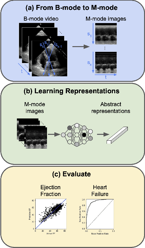 Figure 1 for M(otion)-mode Based Prediction of Ejection Fraction using Echocardiograms