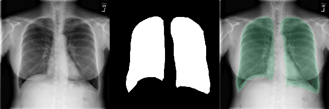 Figure 4 for Lung segmentation with NASNet-Large-Decoder Net