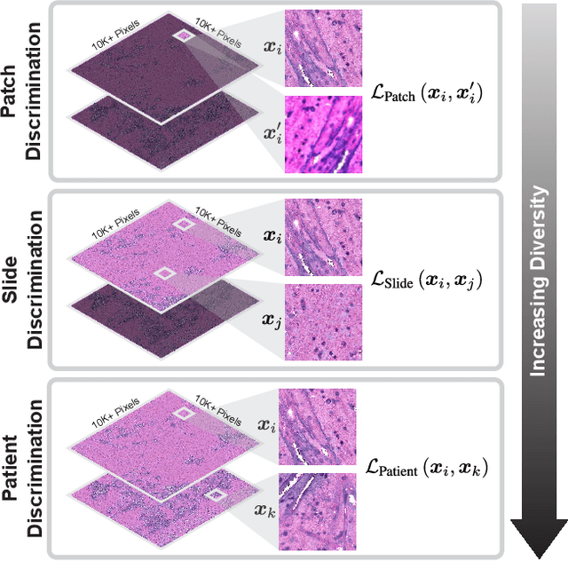 Figure 1 for Hierarchical discriminative learning improves visual representations of biomedical microscopy