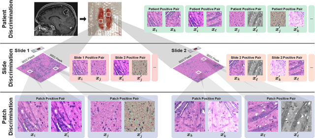 Figure 3 for Hierarchical discriminative learning improves visual representations of biomedical microscopy