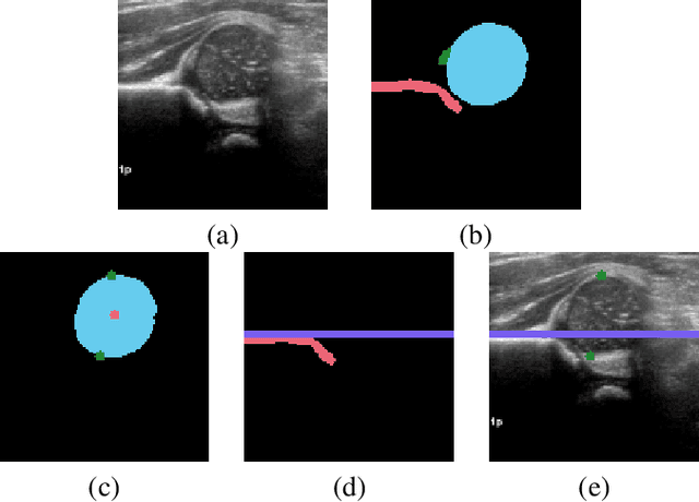 Figure 3 for Infant hip screening using multi-class ultrasound scan segmentation