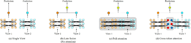 Figure 1 for CTT-Net: A Multi-view Cross-token Transformer for Cataract Postoperative Visual Acuity Prediction