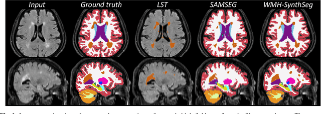 Figure 2 for Quantifying white matter hyperintensity and brain volumes in heterogeneous clinical and low-field portable MRI