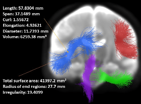 Figure 1 for Cross-domain Fiber Cluster Shape Analysis for Language Performance Cognitive Score Prediction