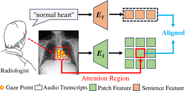 Figure 1 for Eye-gaze Guided Multi-modal Alignment Framework for Radiology