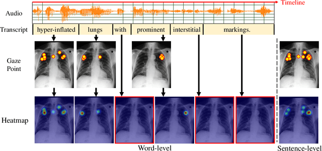 Figure 3 for Eye-gaze Guided Multi-modal Alignment Framework for Radiology