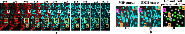Figure 1 for Label-efficient Contrastive Learning-based model for nuclei detection and classification in 3D Cardiovascular Immunofluorescent Images
