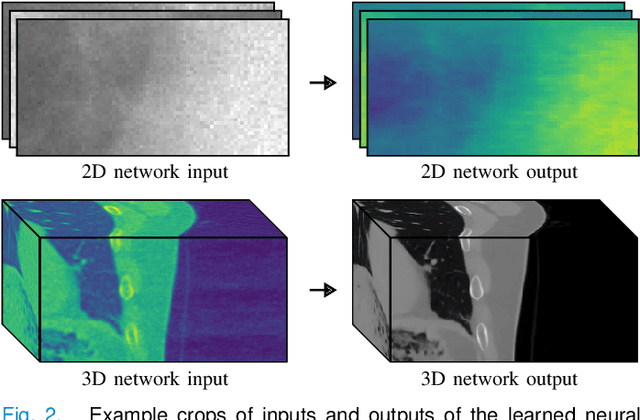 Figure 3 for Projection-Domain Self-Supervision for Volumetric Helical CT Reconstruction