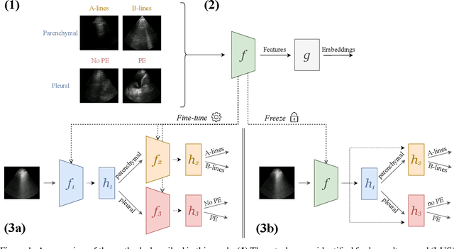 Figure 1 for Self-Supervised Pretraining Improves Performance and Inference Efficiency in Multiple Lung Ultrasound Interpretation Tasks