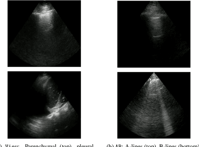 Figure 3 for Self-Supervised Pretraining Improves Performance and Inference Efficiency in Multiple Lung Ultrasound Interpretation Tasks