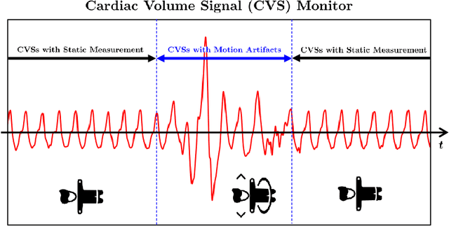 Figure 1 for Machine Learning-based Signal Quality Assessment for Cardiac Volume Monitoring in Electrical Impedance Tomography