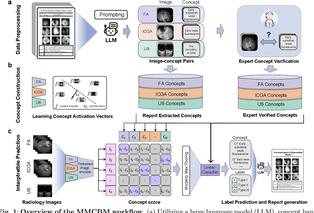 Figure 1 for A Concept-based Interpretable Model for the Diagnosis of Choroid Neoplasias using Multimodal Data