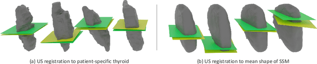 Figure 1 for On the Localization of Ultrasound Image Slices within Point Distribution Models