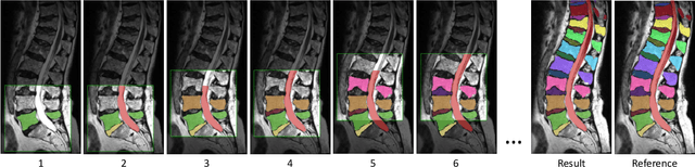 Figure 3 for Lumbar spine segmentation in MR images: a dataset and a public benchmark