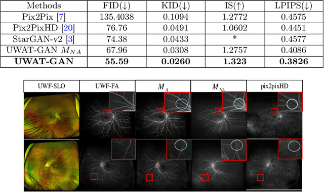 Figure 4 for UWAT-GAN: Fundus Fluorescein Angiography Synthesis via Ultra-wide-angle Transformation Multi-scale GAN